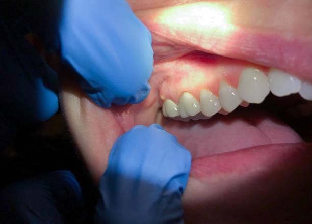 Best Emergency Cosmetic Dentistry (e.g., broken veneers) in South Fulton, TN